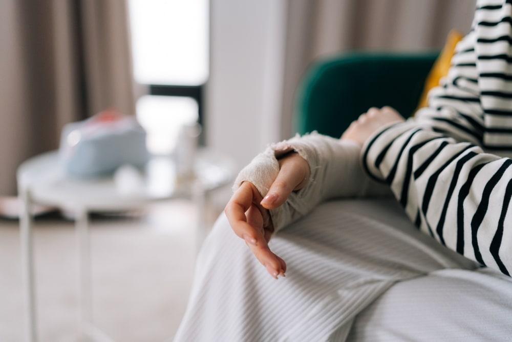 Photo of an Injured Hand